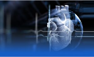 Šiuolaikinė kardiologija: Išeminės širdies ligos diagnostika ir gydymas
